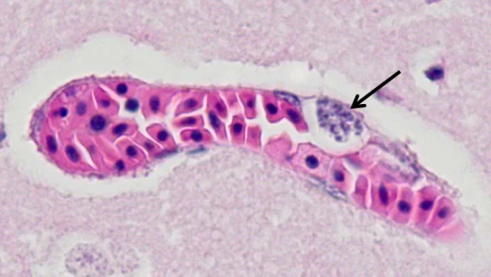 brain_parasites_web.jpg