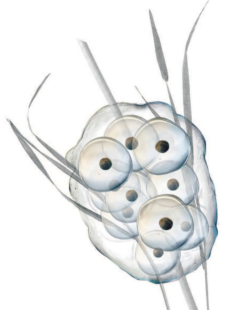 Blue spotted salamander eggs