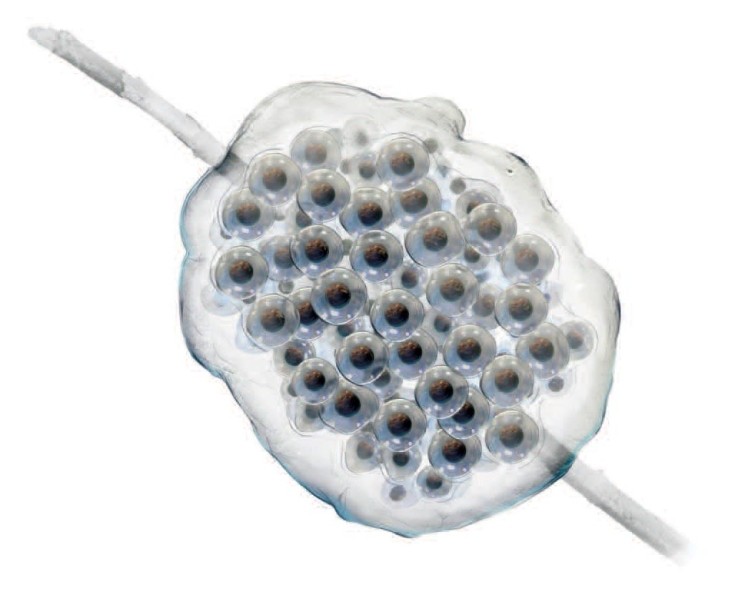 Spotted salamander eggs